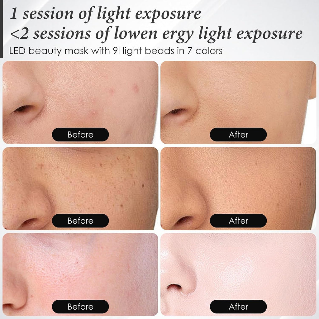 SDKWDH Red Light Therapy Mask for Face Led Face Mask Light Therapy At Home 7 Colors LED Face Mask Light Therapy White My Modern Mart